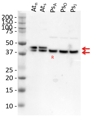 Western blot using anti-GS (global Gln1/Gln2) antibodies